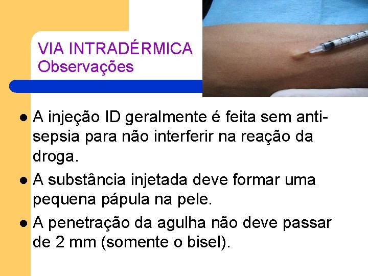VIA INTRADÉRMICA Observações A injeção ID geralmente é feita sem antisepsia para não interferir VIA INTRADÉRMICA Observações A injeção ID geralmente é feita sem antisepsia para não interferir