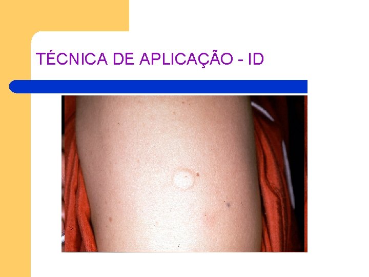 TÉCNICA DE APLICAÇÃO - ID TÉCNICA DE APLICAÇÃO - ID