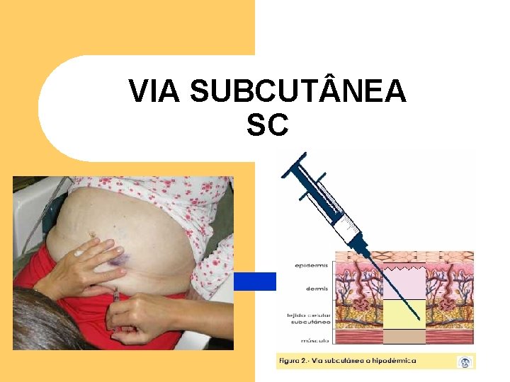 VIA SUBCUT NEA SC VIA SUBCUT NEA SC