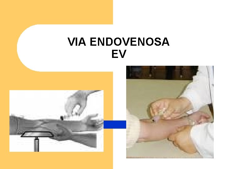VIA ENDOVENOSA EV VIA ENDOVENOSA EV