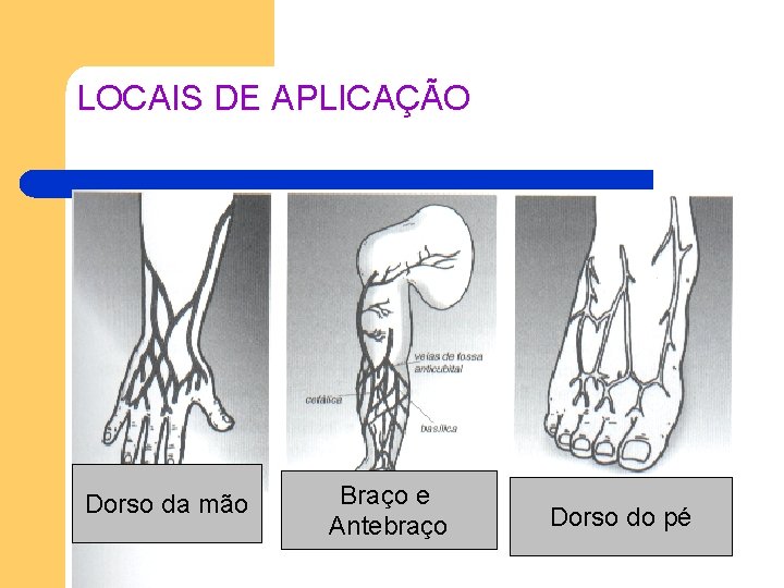 LOCAIS DE APLICAÇÃO Dorso da mão Braço e Antebraço Dorso do pé LOCAIS DE APLICAÇÃO Dorso da mão Braço e Antebraço Dorso do pé