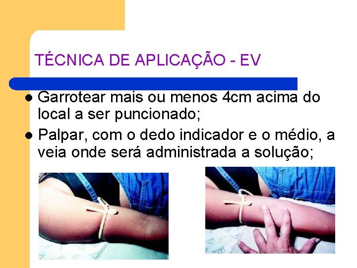 TÉCNICA DE APLICAÇÃO - EV Garrotear mais ou menos 4 cm acima do local TÉCNICA DE APLICAÇÃO - EV Garrotear mais ou menos 4 cm acima do local