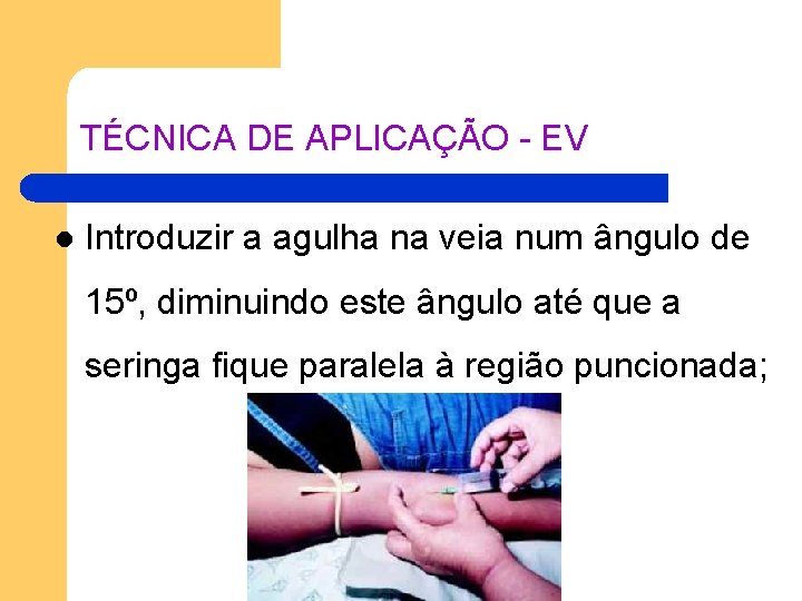 TÉCNICA DE APLICAÇÃO - EV l Introduzir a agulha na veia num ângulo de TÉCNICA DE APLICAÇÃO - EV l Introduzir a agulha na veia num ângulo de