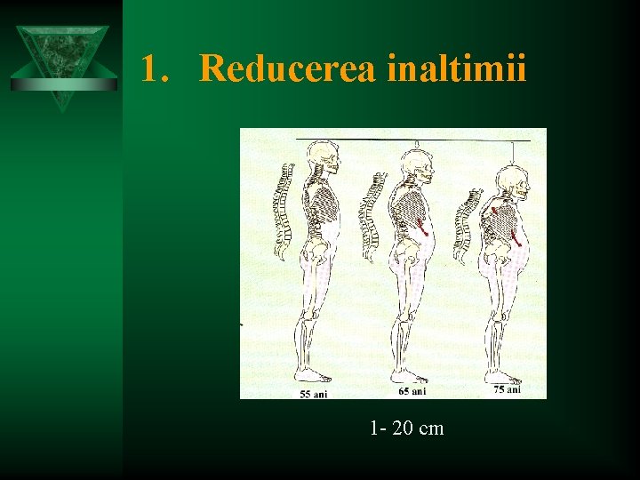 1. Reducerea inaltimii 1 - 20 cm 
