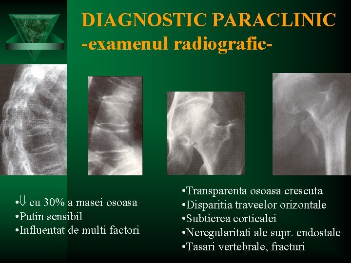 DIAGNOSTIC PARACLINIC -examenul radiografic- • cu 30% a masei osoasa • Putin sensibil •