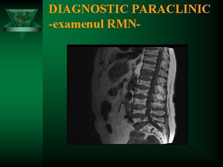 DIAGNOSTIC PARACLINIC -examenul RMN- 