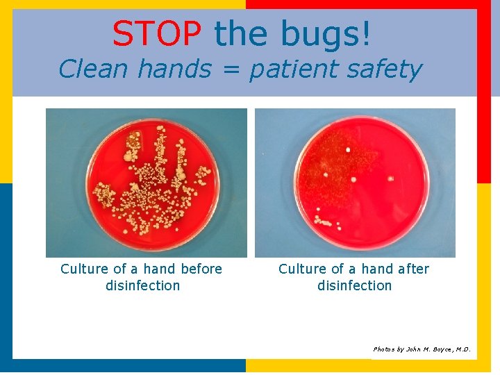 STOP the bugs! Clean hands = patient safety Culture of a hand before disinfection