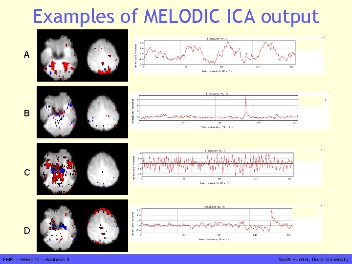 Examples of MELODIC ICA output A B C D FMRI – Week 10 –