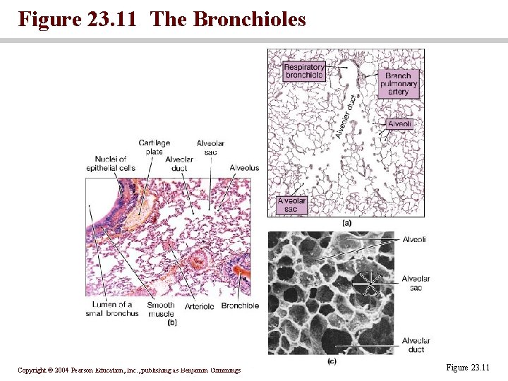 Figure 23. 11 The Bronchioles Copyright © 2004 Pearson Education, Inc. , publishing as