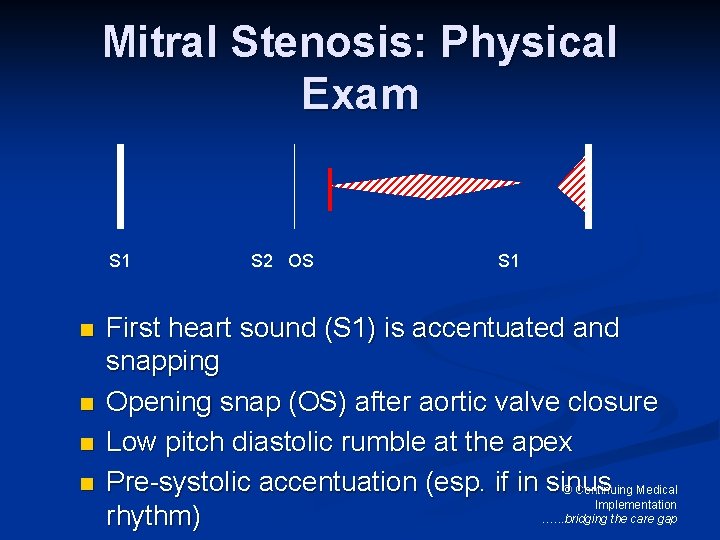 Mitral Stenosis: Physical Exam S 1 n n S 2 OS S 1 First