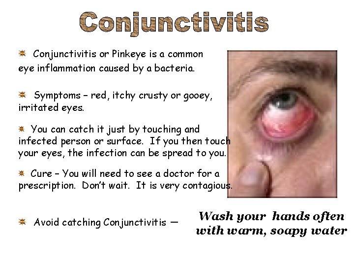 Conjunctivitis or Pinkeye is a common eye inflammation caused by a bacteria. Symptoms –