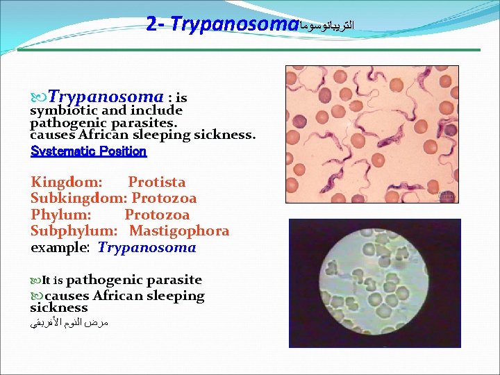 2 - Trypanosoma ﺍﻟﺘﺮﻳﺒﺎﻧﻮﺳﻮﻣﺎ Trypanosoma : is symbiotic and include pathogenic parasites. causes African