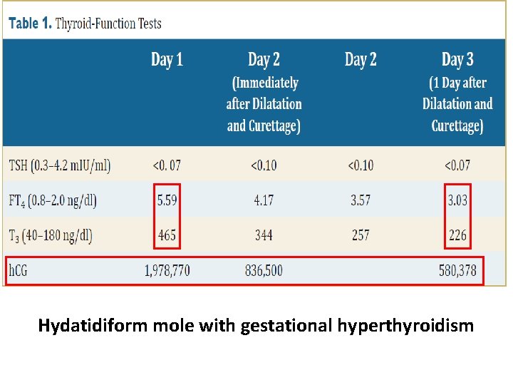 Hydatidiform mole with gestational hyperthyroidism 