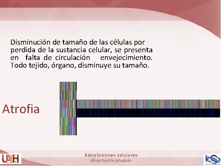 Disminución de tamaño de las células por perdida de la sustancia celular, se presenta