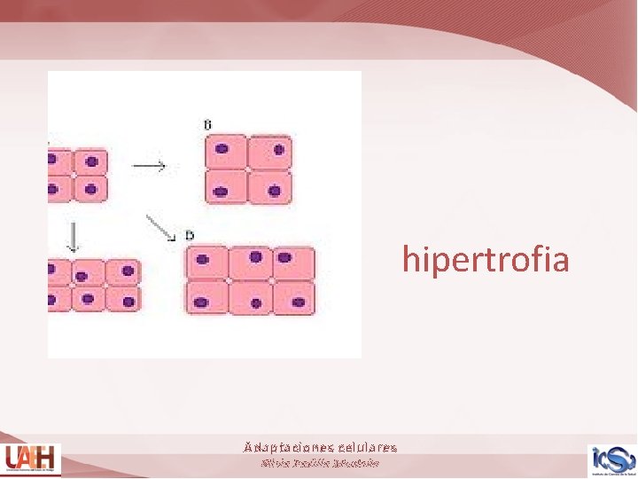 hipertrofia Adaptaciones celulares Silvia Padilla Montaño 