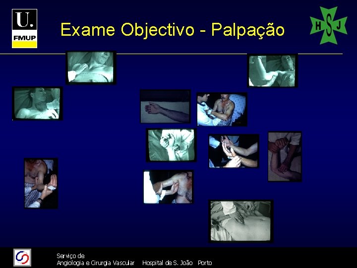 Exame Objectivo - Palpação 11/26/2020 26/11/2020 Serviço de Angiologia e Cirurgia Vascular 10 Hospital