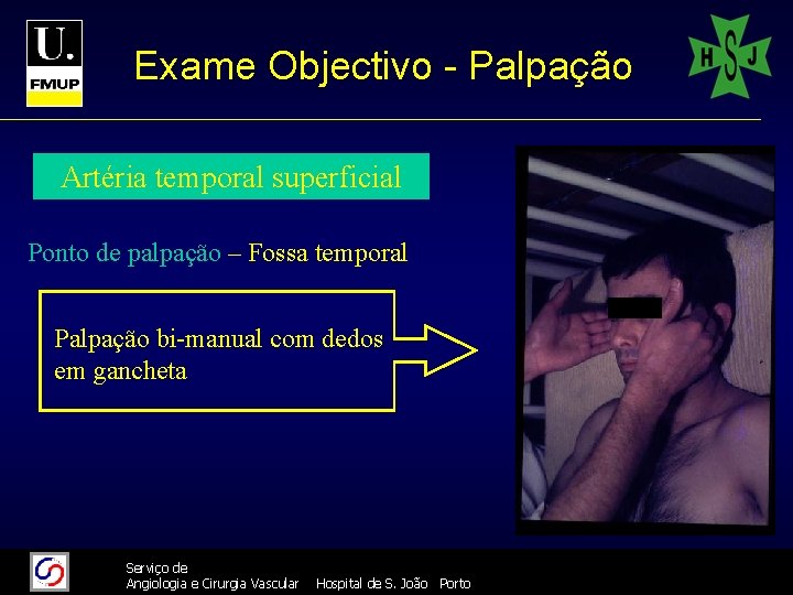 Exame Objectivo - Palpação Artéria temporal superficial Ponto de palpação – Fossa temporal Palpação