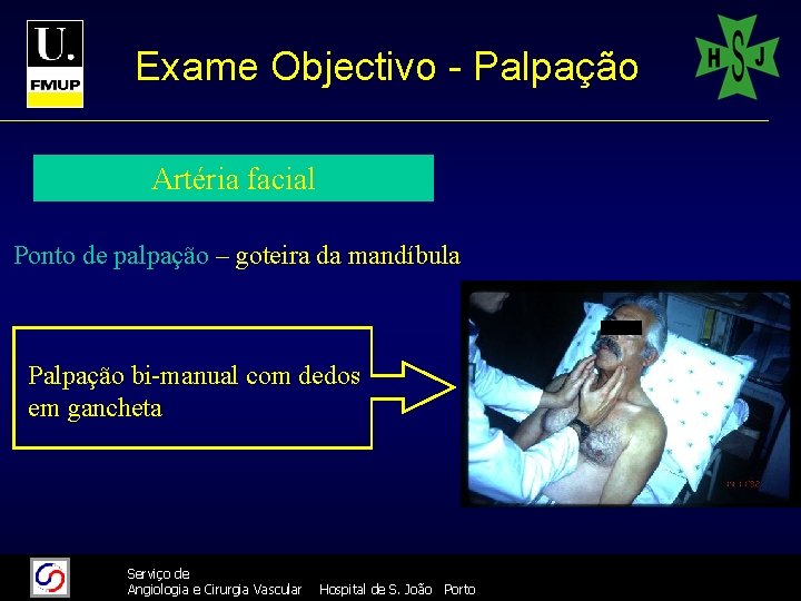 Exame Objectivo - Palpação Artéria facial Ponto de palpação – goteira da mandíbula Palpação