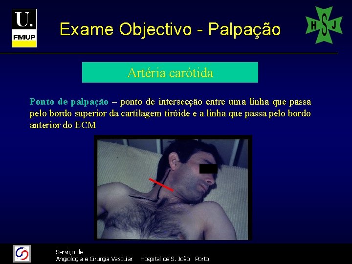 Exame Objectivo - Palpação Artéria carótida Ponto de palpação – ponto de intersecção entre