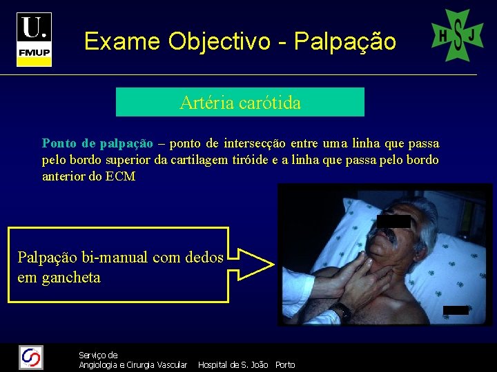 Exame Objectivo - Palpação Artéria carótida Ponto de palpação – ponto de intersecção entre