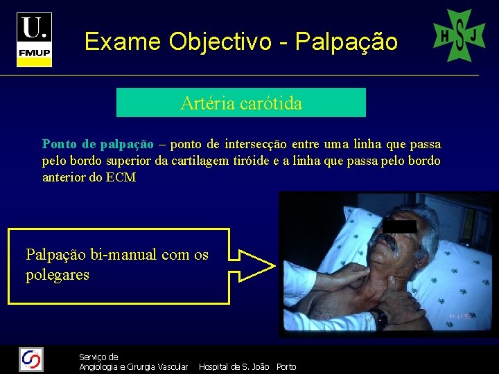 Exame Objectivo - Palpação Artéria carótida Ponto de palpação – ponto de intersecção entre