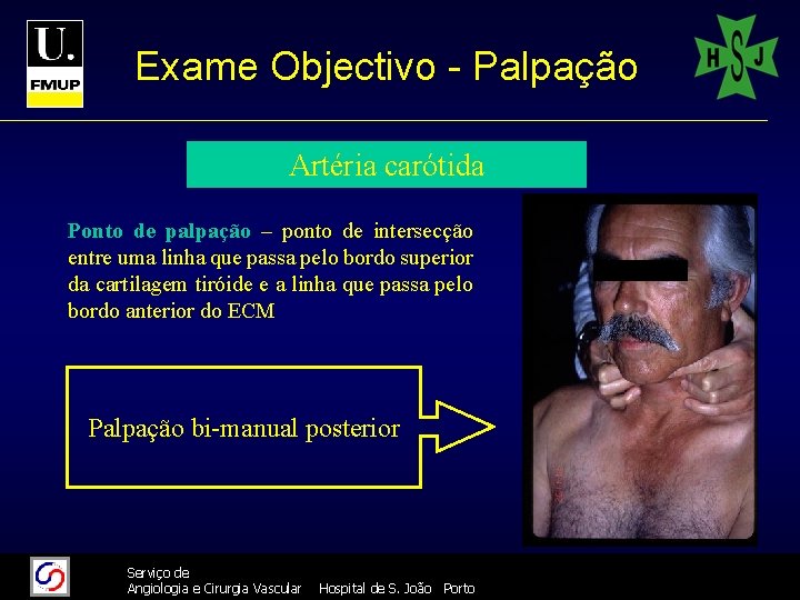 Exame Objectivo - Palpação Artéria carótida Ponto de palpação – ponto de intersecção entre