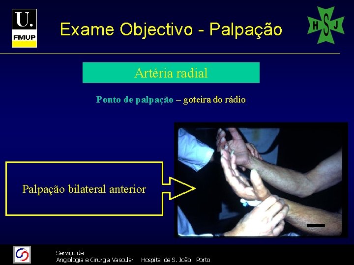 Exame Objectivo - Palpação Artéria radial Ponto de palpação – goteira do rádio Palpação