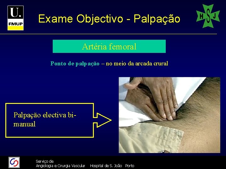 Exame Objectivo - Palpação Artéria femoral Ponto de palpação – no meio da arcada