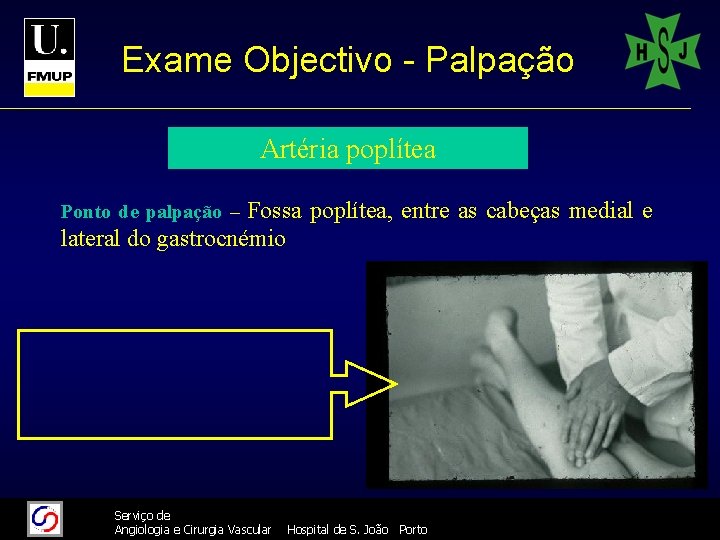 Exame Objectivo - Palpação Artéria poplítea Fossa poplítea, entre as cabeças medial e lateral