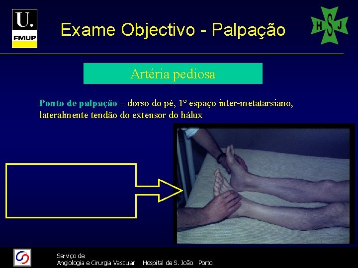 Exame Objectivo - Palpação Artéria pediosa Ponto de palpação – dorso do pé, 1º