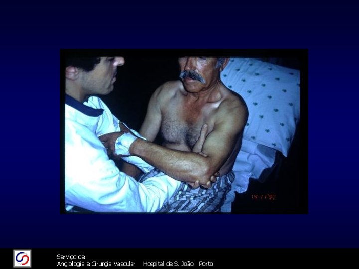 11/26/2020 26/11/2020 Serviço de Angiologia e Cirurgia Vascular 61 Hospital de S. João Porto