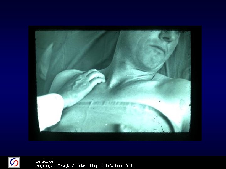 11/26/2020 26/11/2020 Serviço de Angiologia e Cirurgia Vascular 63 Hospital de S. João Porto