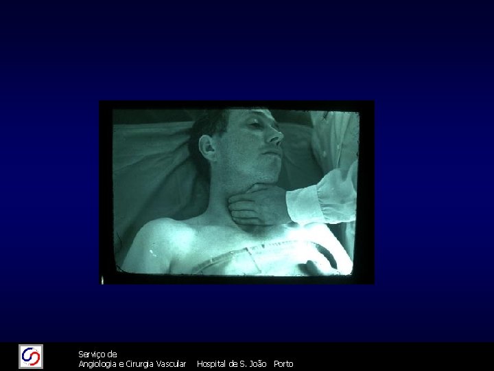 11/26/2020 26/11/2020 Serviço de Angiologia e Cirurgia Vascular 70 Hospital de S. João Porto