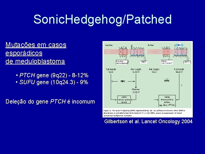 Sonic. Hedgehog/Patched Mutações em casos esporádicos de meduloblastoma • PTCH gene (9 q 22)