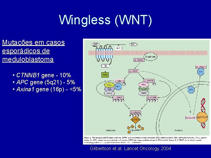 Wingless (WNT) Mutações em casos esporádicos de meduloblastoma • CTNNB 1 gene - 10%