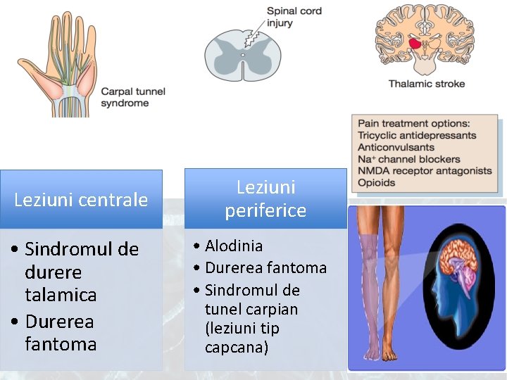 Leziuni centrale • Sindromul de durere talamica • Durerea fantoma Leziuni periferice • Alodinia