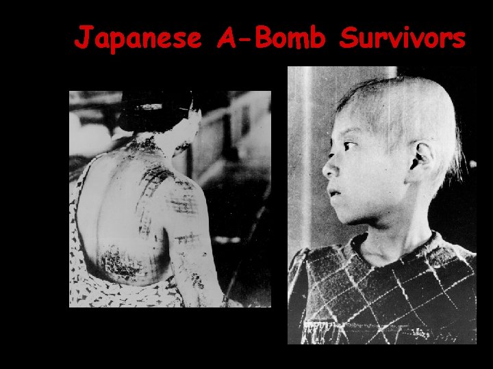Japanese A-Bomb Survivors 