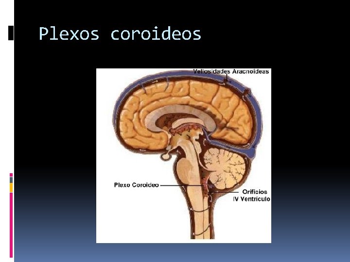 Plexos coroideos 