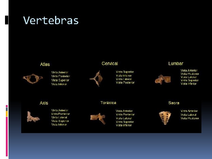 Vertebras 