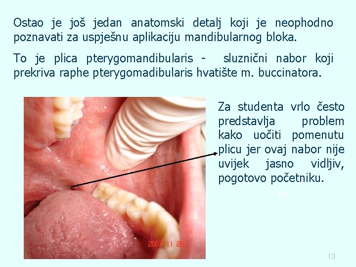 Ostao je još jedan anatomski detalj koji je neophodno poznavati za uspješnu aplikaciju mandibularnog