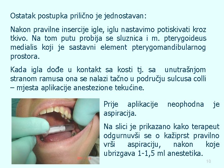 Ostatak postupka prilično je jednostavan: Nakon pravilne insercije igle, iglu nastavimo potiskivati kroz tkivo.