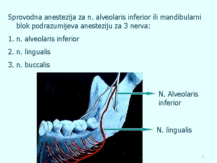 Sprovodna anestezija za n. alveolaris inferior ili mandibularni blok podrazumijeva anesteziju za 3 nerva: