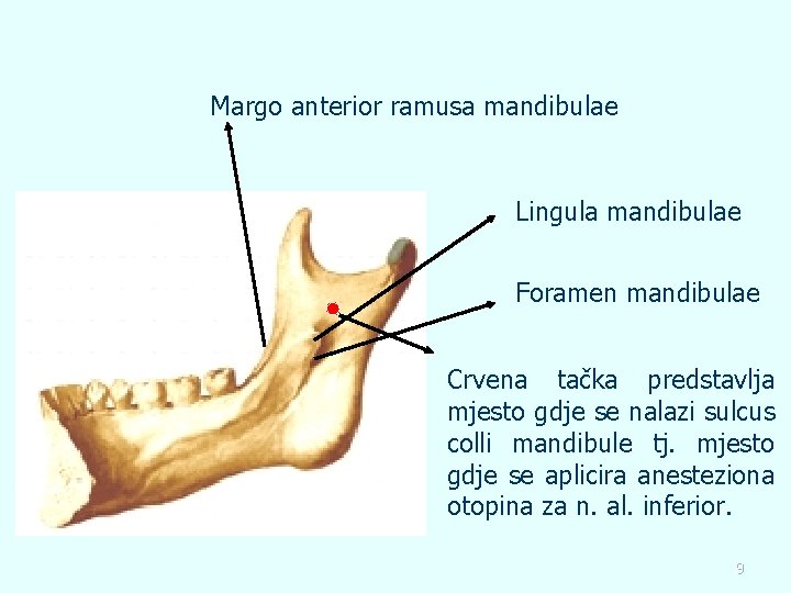 Margo anterior ramusa mandibulae Lingula mandibulae Foramen mandibulae Crvena tačka predstavlja mjesto gdje se