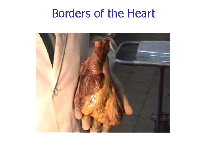 Borders of the Heart 