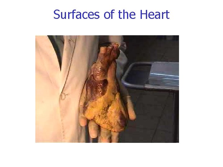 Surfaces of the Heart Surfaces of the Heart