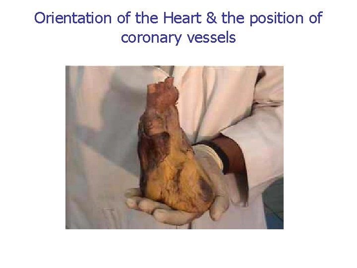 Orientation of the Heart & the position of coronary vessels 