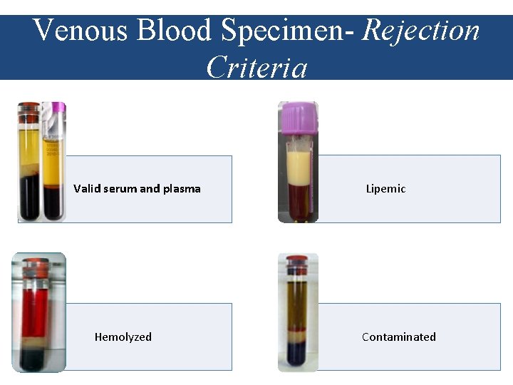 Venous Blood Specimen- Rejection Criteria Valid serum and plasma Hemolyzed Lipemic Contaminated 