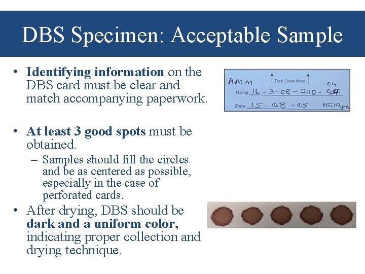 DBS Specimen: Acceptable Sample • Identifying information on the DBS card must be clear