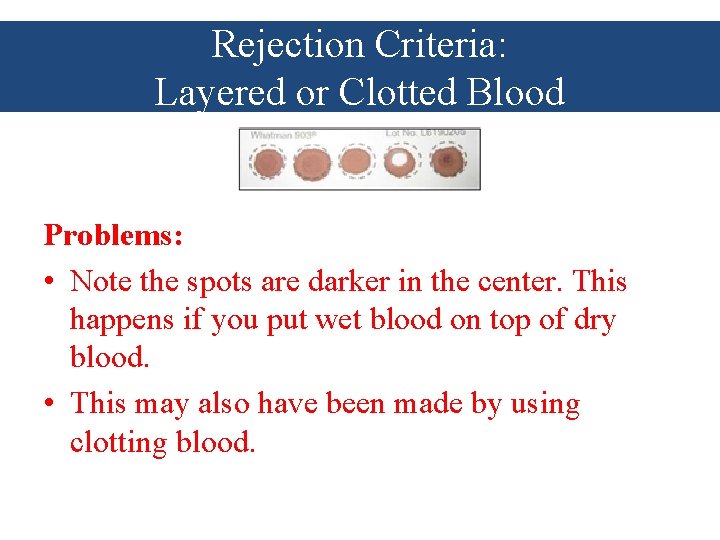 Rejection Criteria: Layered or Clotted Blood Problems: • Note the spots are darker in
