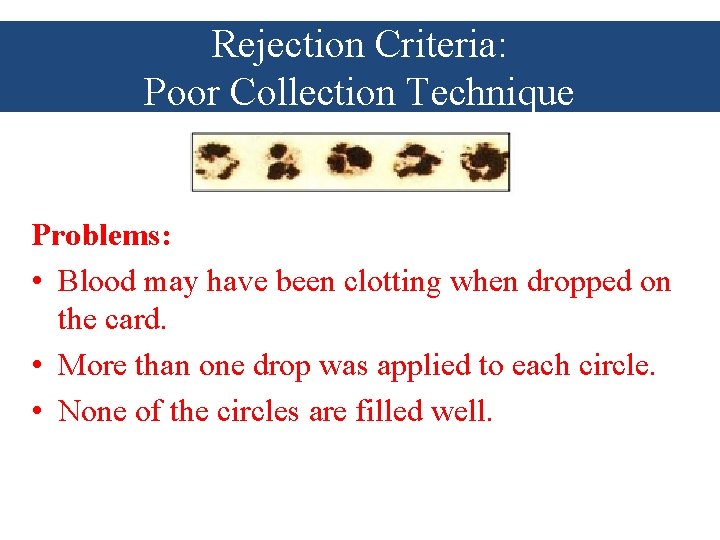 Rejection Criteria: Poor Collection Technique Problems: • Blood may have been clotting when dropped